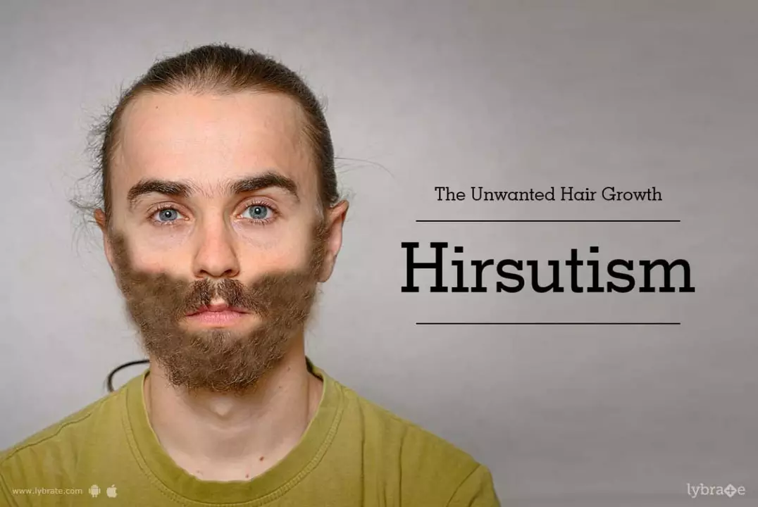 Hirsutism in the Workplace: How to Handle Unwanted Hair Growth