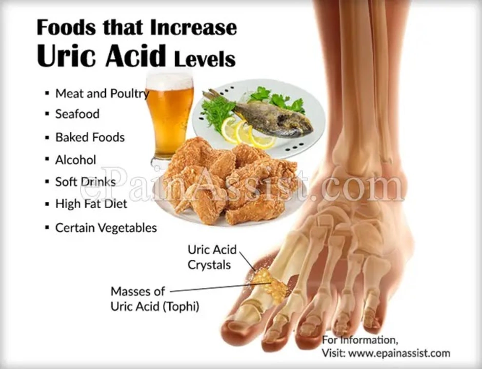 The impact of high uric acid levels on the immune system